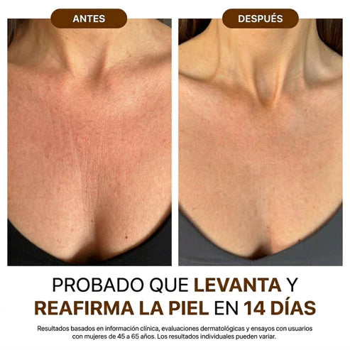 NovaPure Oil® Aceite corporal de seda