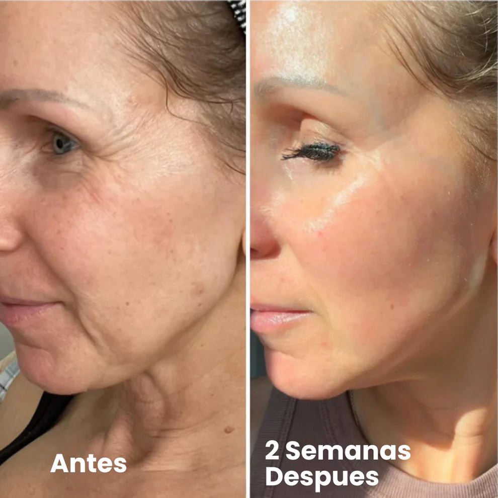 Retinal Shot –Efecto piel firme tipo lifting sin agujas