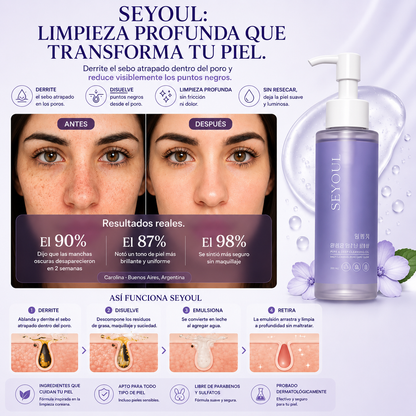 MELTY™-Derrite los Puntos Negros y Limpia tus Poros Sin Maltratar tu Piel