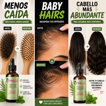 Mielle Rosemary Oil – Reduce La Caída Y Estimula El Crecimiento
