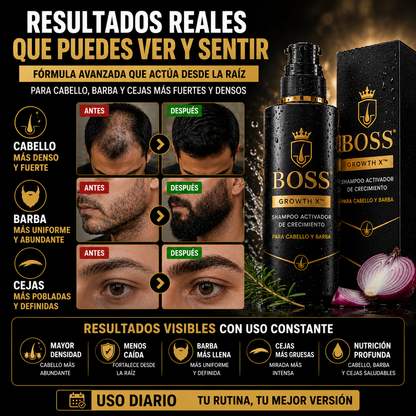 BOSS GROWTH X™ – Activador de Crecimiento para Cabello y Barba