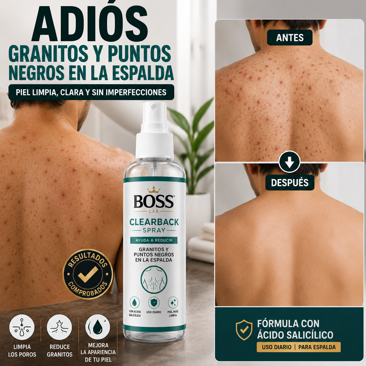 ClearBack Spray – Ayuda a Reducir Granitos y Puntos Negros en la Espalda