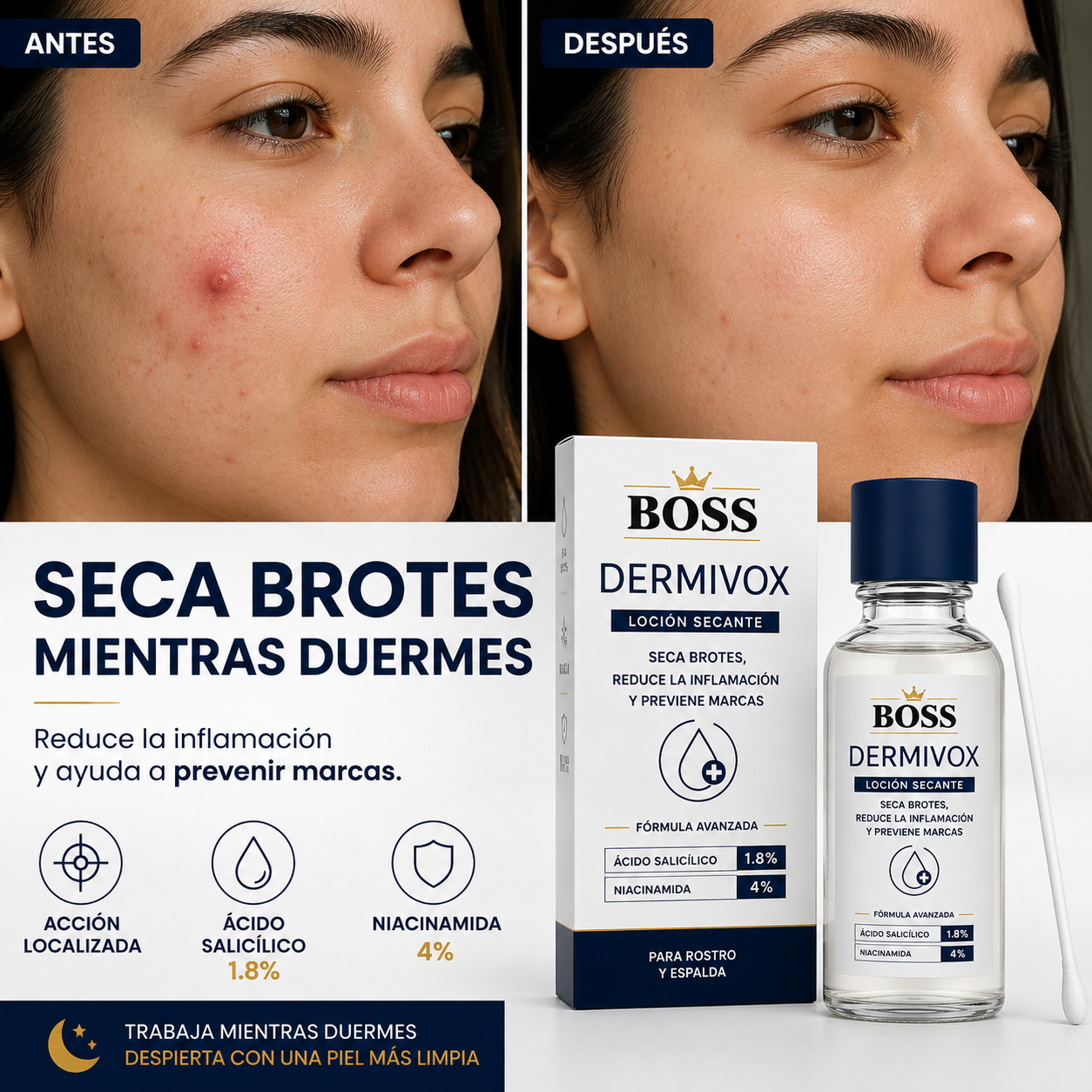 Dermivox – Seca Brotes, Reduce la Inflamación y Previene Marcas