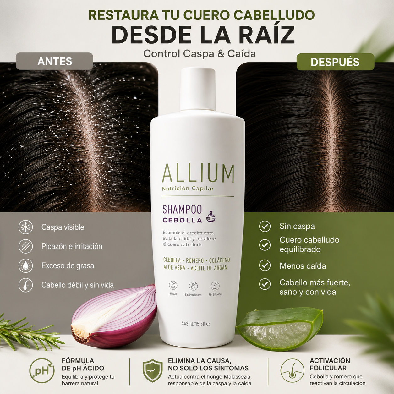 ALLIUM — Restauración Capilar Control Caspa & Caída