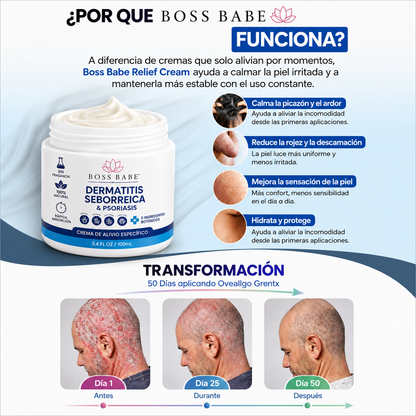 DERMATITIS SEBORREICA & PSORIASIS- Crema de Alivio Específico.