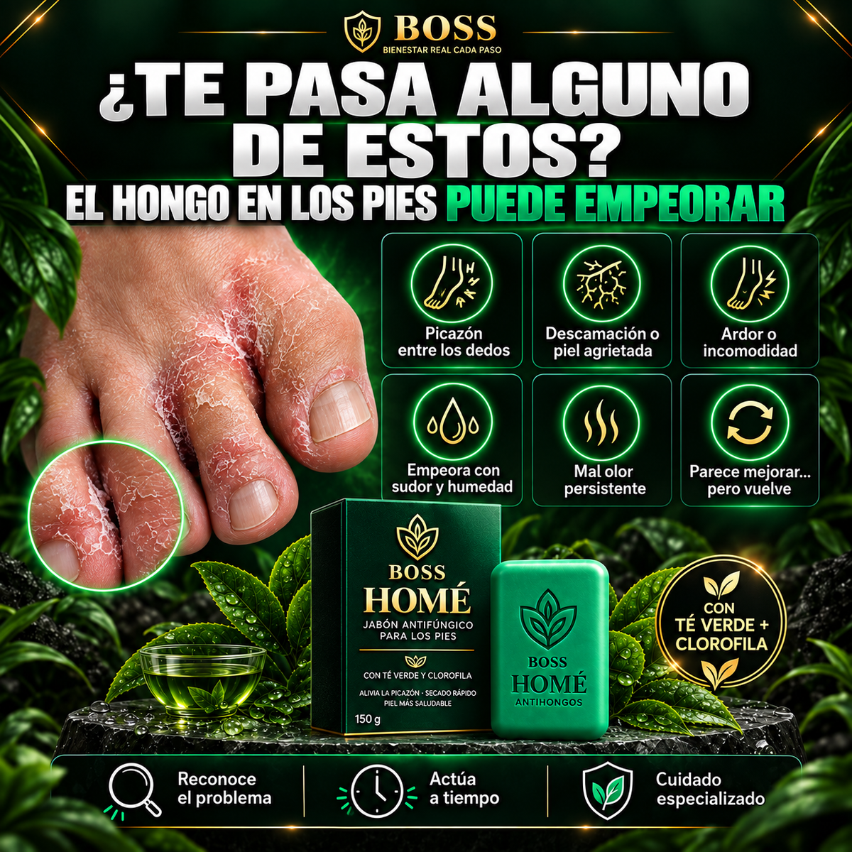 BOSS HOMÉ™ | Jabón Antifúngico para el Cuidado de los Pies