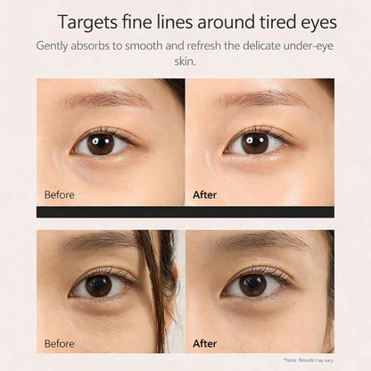 Eye Reset Pro™-Tratamiento avanzado para ojeras, bolsas y líneas de expresión