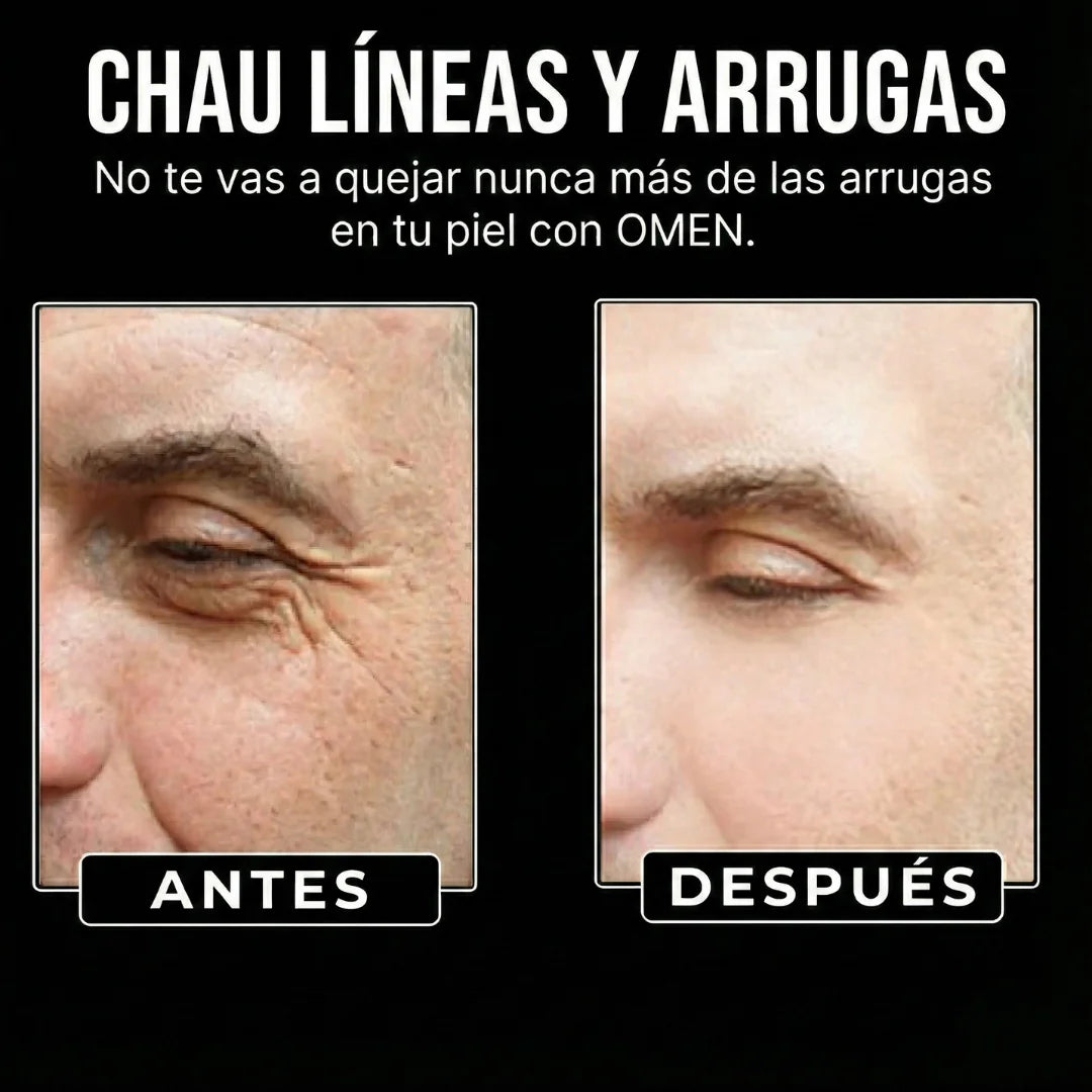 OMEN Serum anti-edad para Hombre