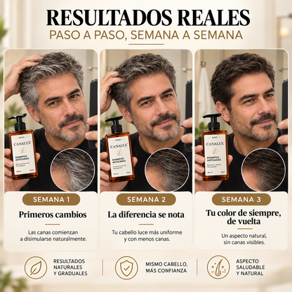 CANALEX™ – Recupera tu Color de Forma Gradual.