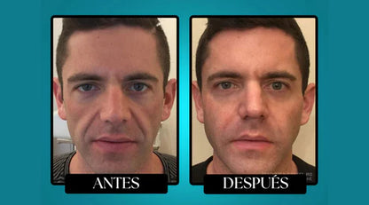 Morge™ Bálsamo de Sebo Bovino Antiedad para Hombres (Tiktok)