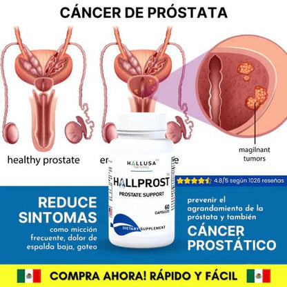 HALLPROST - Tratamiento Completo para la prostata