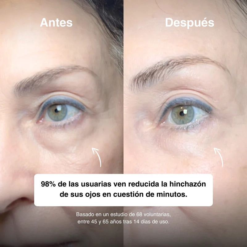 Fresh Eyes Roll-On – Frío activo para bolsas, ojeras oscuras y patas de gallo
