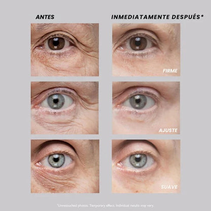 Lifting Ocular-Adiós Bolsas Al Instante