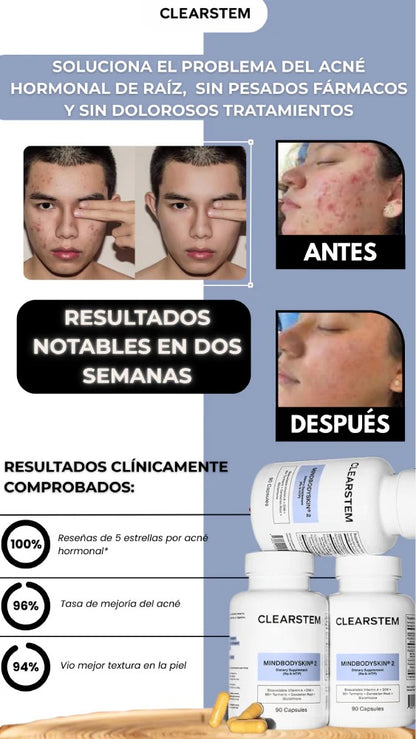 CLEARSTEM-Control Interno Del Acne