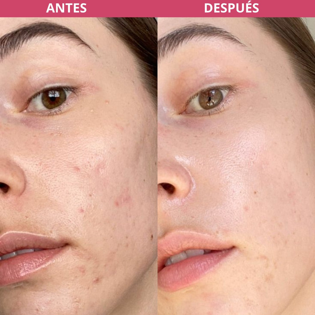 Labif-Efecto Filtro Facial Avanzado