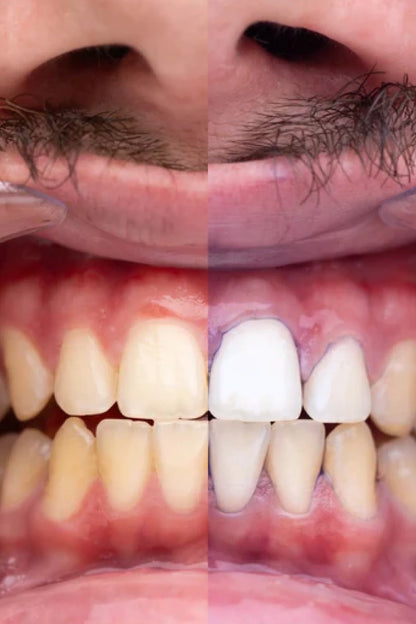 OBSESSIVE- Pasta dental blanqueadora morada