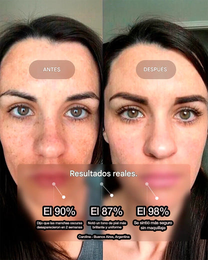 Eliré-Corrector de manchas oscuras para una luminosidad visible
