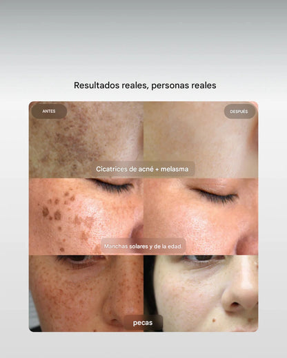 Eliré-Corrector de manchas oscuras para una luminosidad visible
