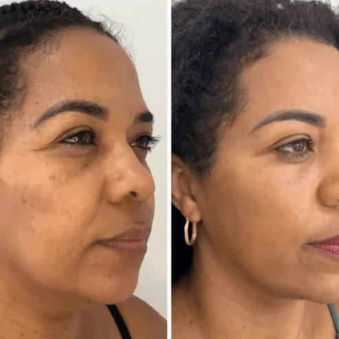 Collagen Fit™-Mascarilla de Colágeno Coreana Rejuvenecedora