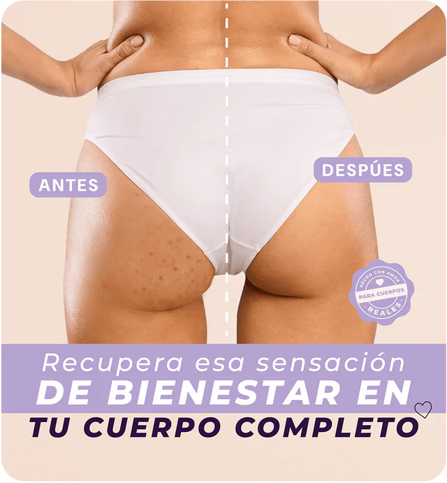 Gluwen Gel-Olvídate de los granitos en los glúteos